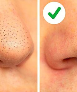 Ủ Mũi Xử Lý Mụn Đầu Đen Remove Blackheads Hàn Quốc 50ml